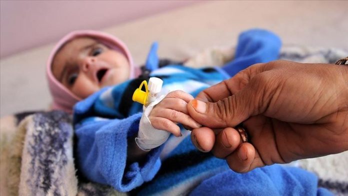 4mn children and mothers suffer from malnutrition in Yemen