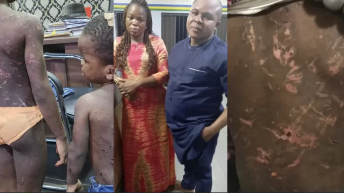 Police arrest couple for brutalizing children