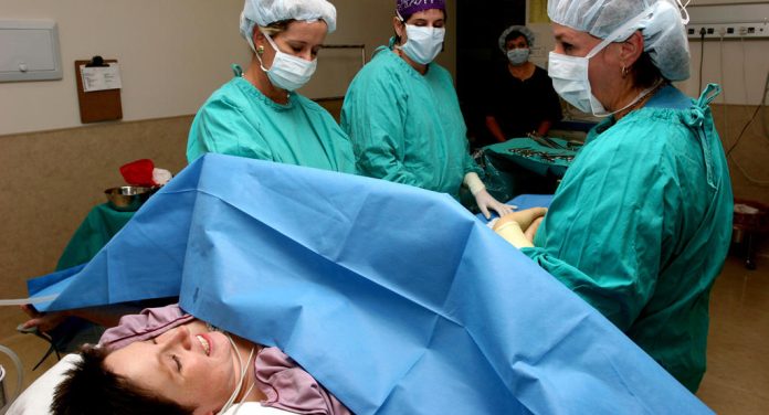 Facts about caesarean section you probably didn’t know