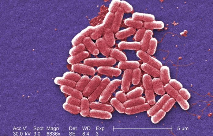 UK: One person dies amid ongoing E.coli outbreak